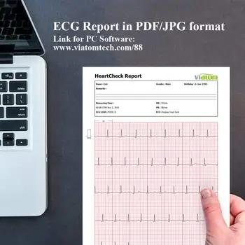 EKG/EKG Holter Tracker Bærbare Husstand Sundhed Sats Oximeter med Blood pressure Monitor PC eller en bluetooth-APP til Fitness-Sport